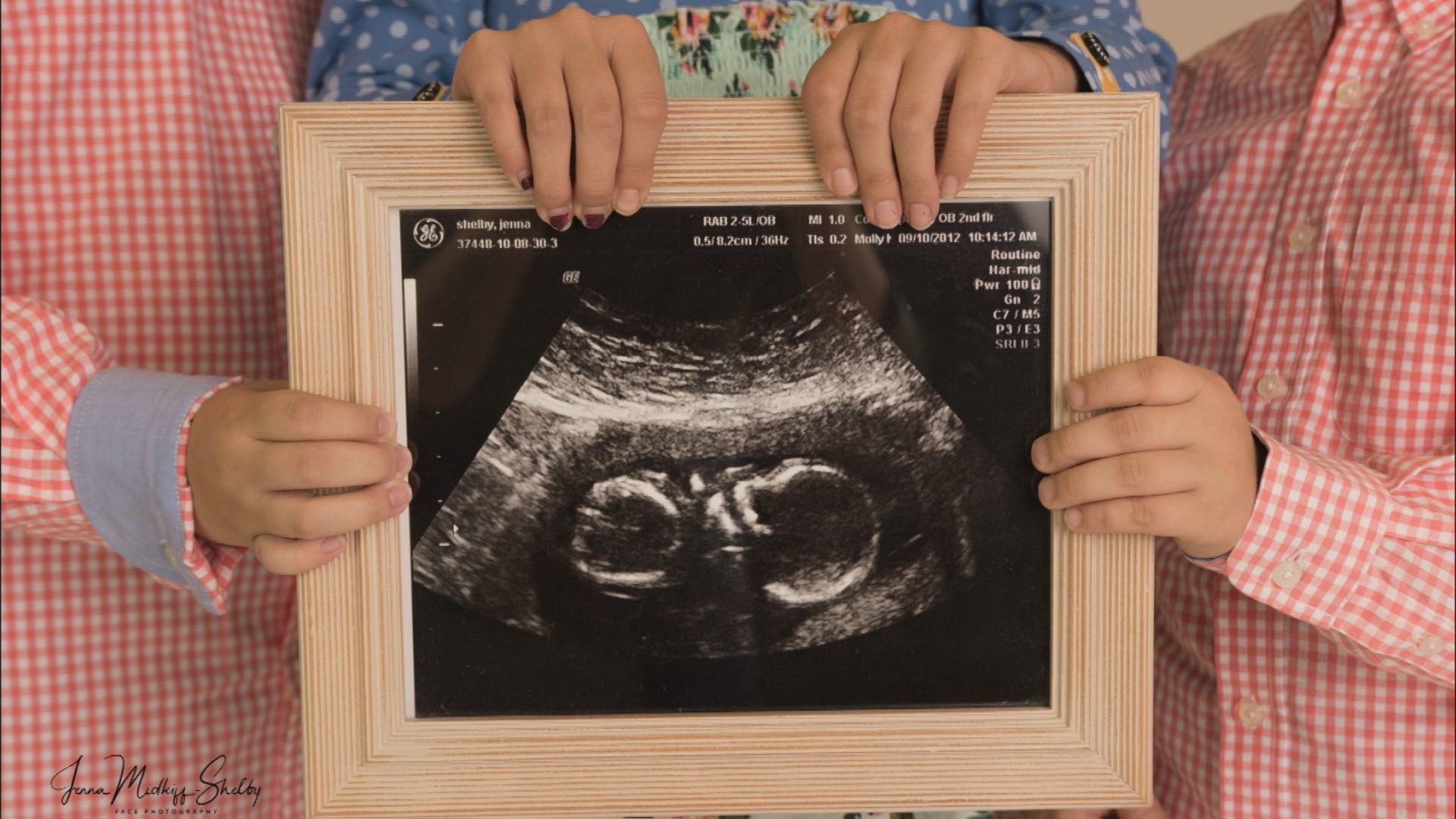Ultrasound